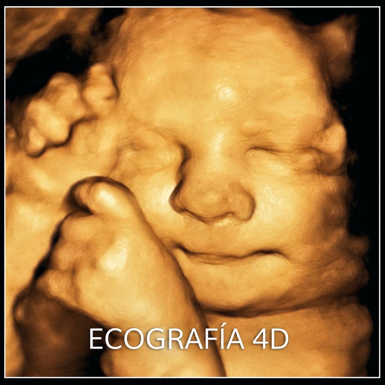 Ecógrafo 4D de CIMA Apóstoles
